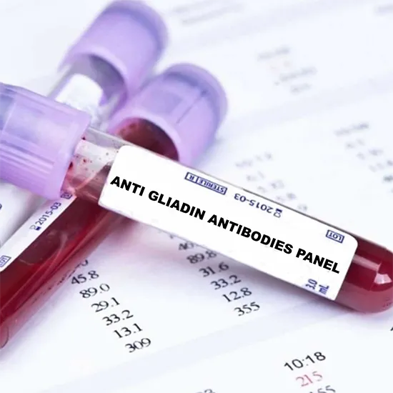 anti gliadin antibody igg test